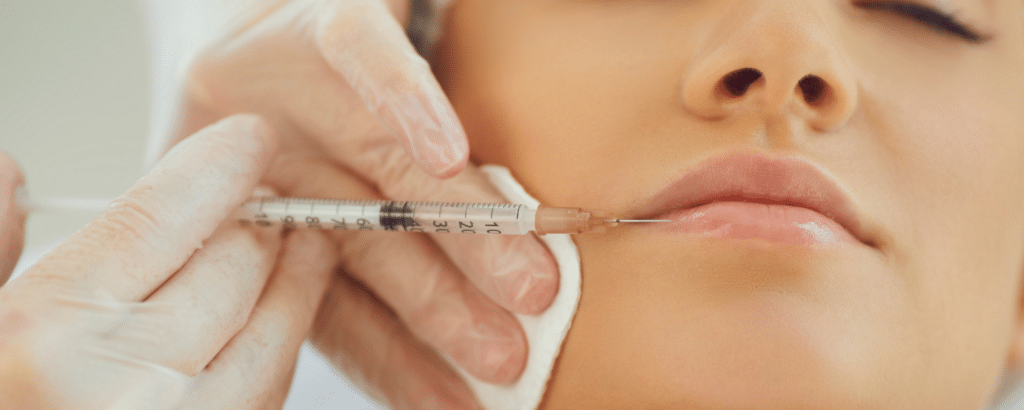 Comparaison visuelle entre acide hyaluronique et botox mettant en évidence les zones d'application