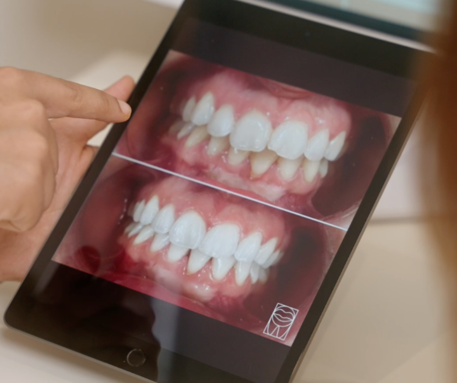 English speaking dentiste in Paris : dental cares, urgencies, comestic dentistry