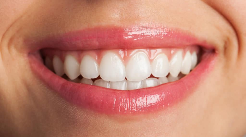 Comment avoir les dents blanches et les conserver ? Paris Dental Studios