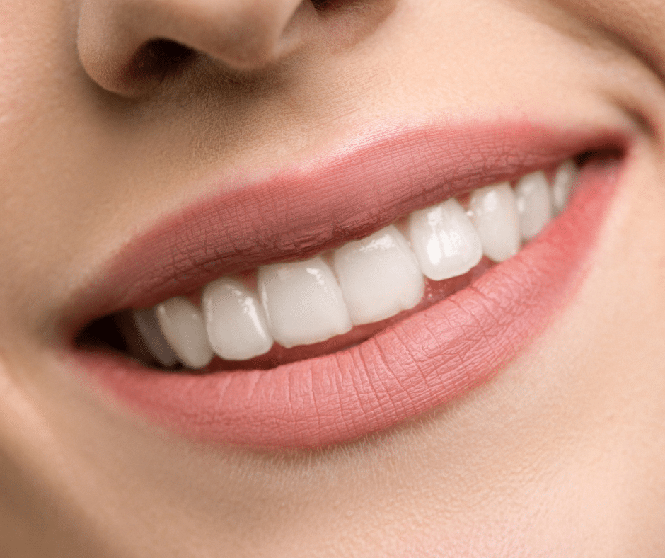 Comment avoir ls dents blanches Paris Dental Studios