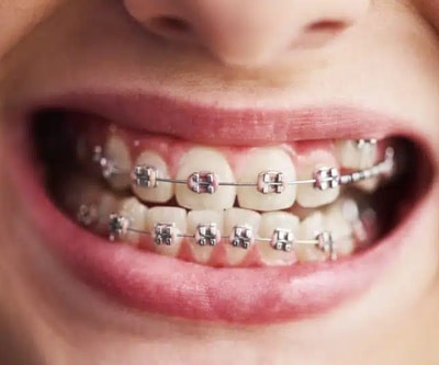 Bilan orthodontique