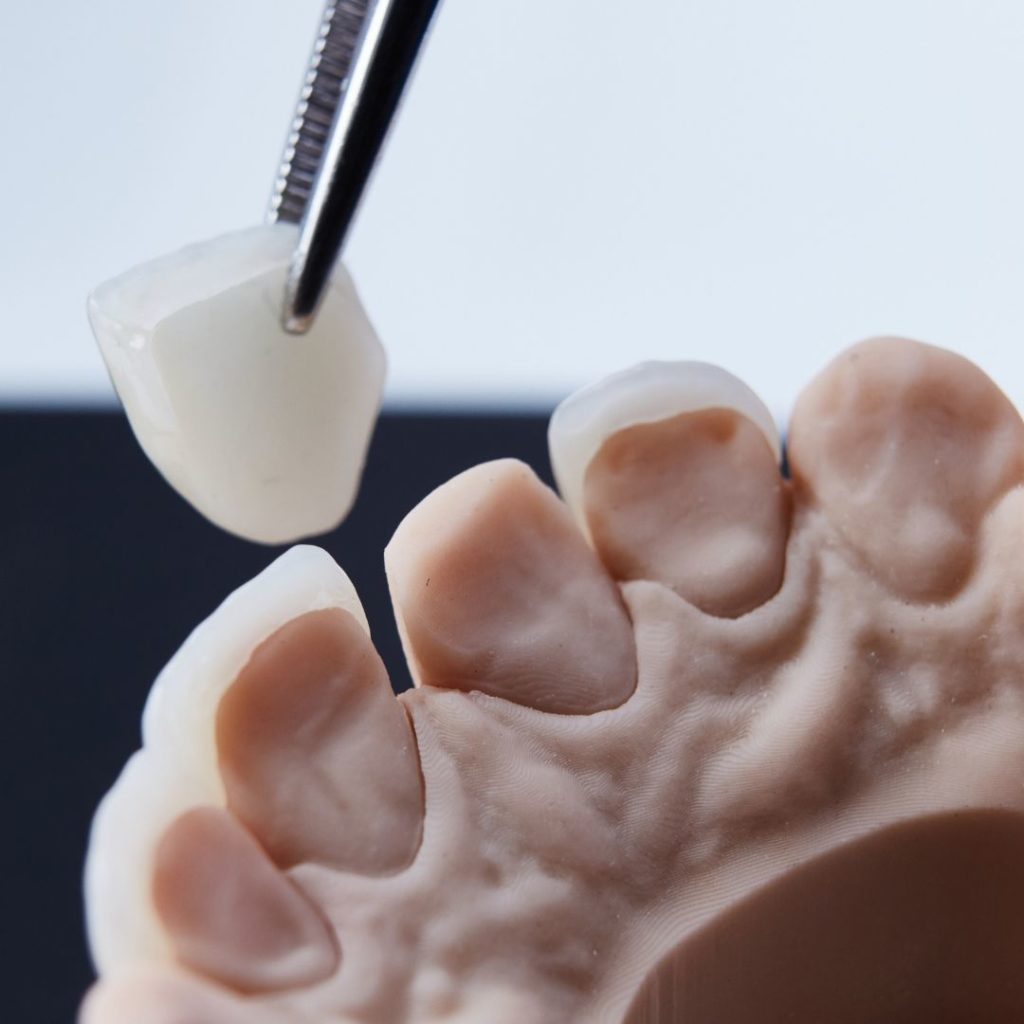 dentiste : blanchiment, aligneurs invisibles, facettes dentaires, implant dentaire, soins dentaires, urgences dentaires