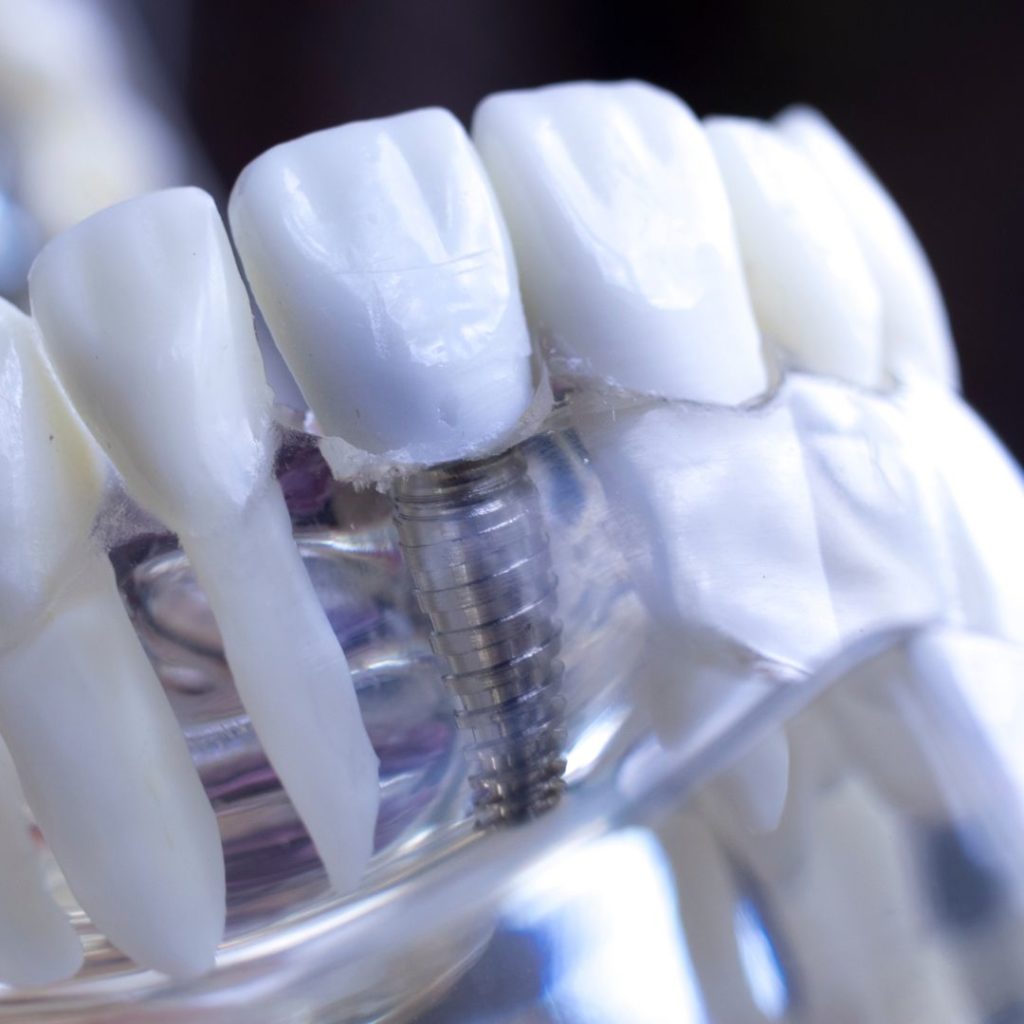 dentiste : blanchiment, aligneurs invisibles, facettes dentaires, implant dentaire, soins dentaires, urgences dentaires