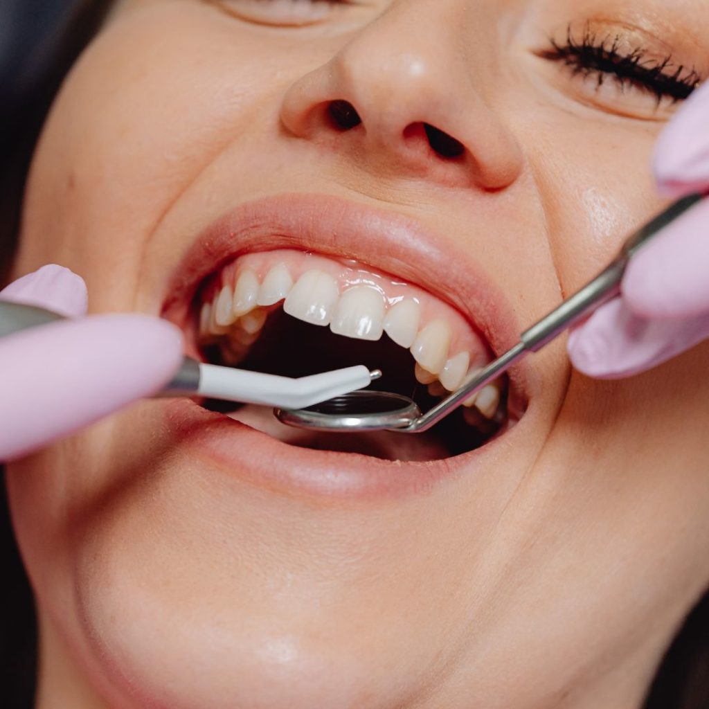 dentiste : blanchiment, aligneurs invisibles, facettes dentaires, implant dentaire, soins dentaires, urgences dentaires