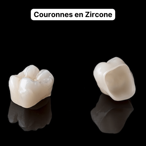 Couronnes en Zircone Choisir le bonne prothèse dentaire