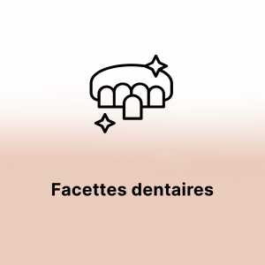 Facettes dentaires